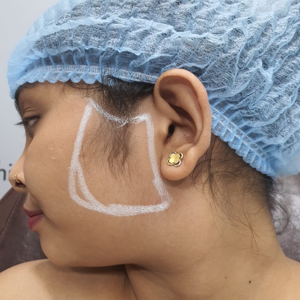 Figure First Aesthetic Clinic Ahmedabad