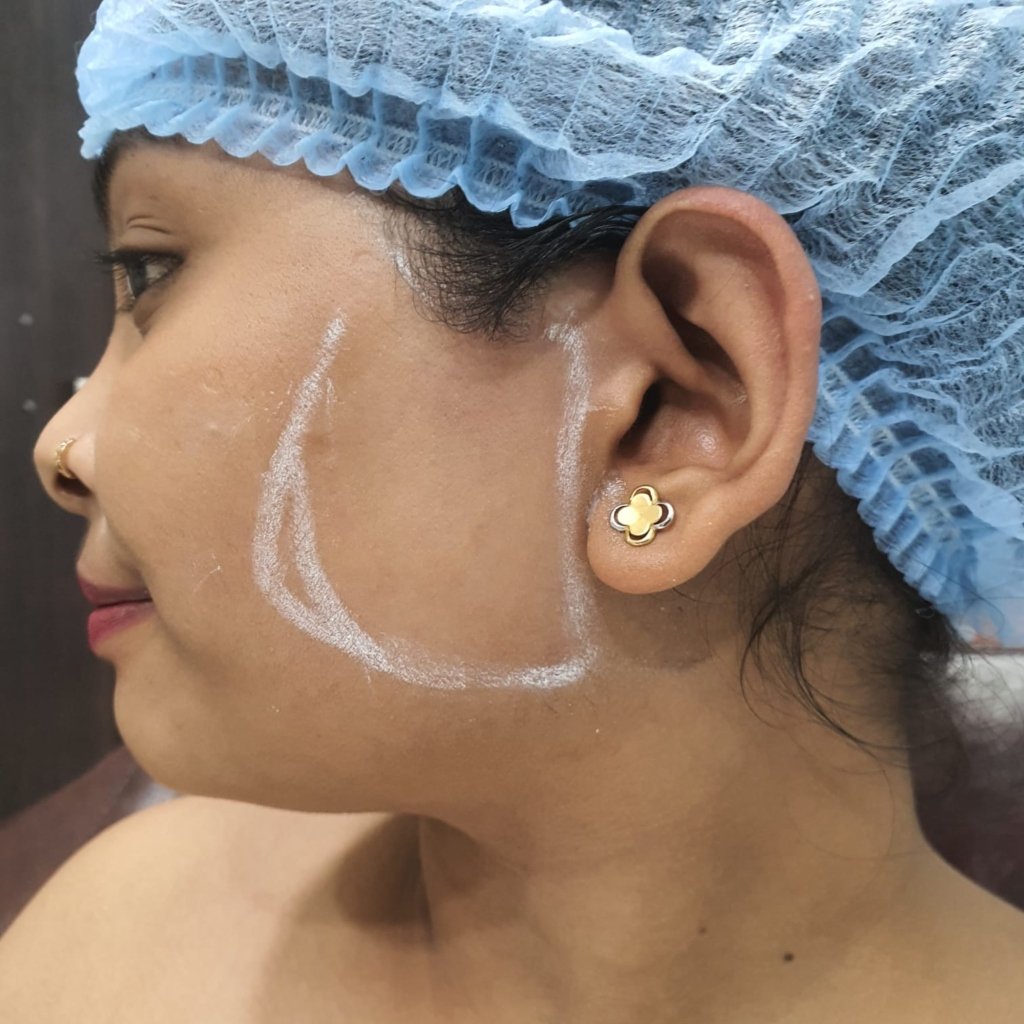 Figure First Aesthetic Clinic Ahmedabad